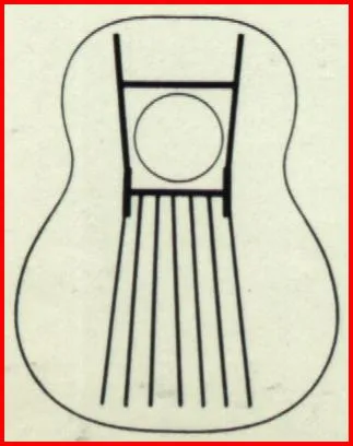 Ovation A Bracing