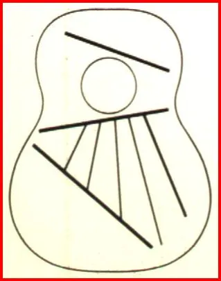 Ovation VT-11 Bracing